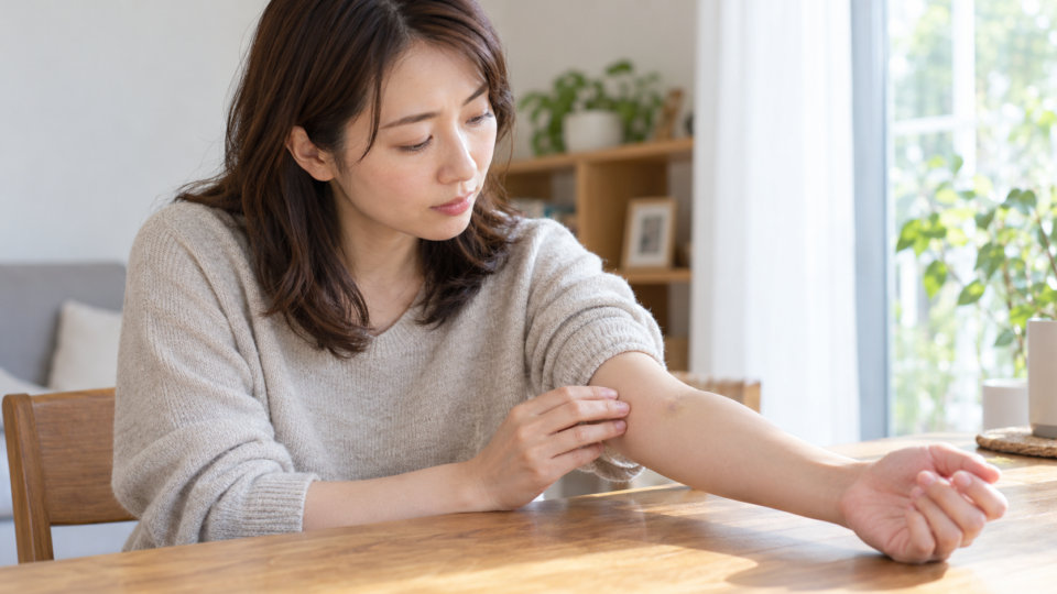 前腕の小さなあざを確認する女性